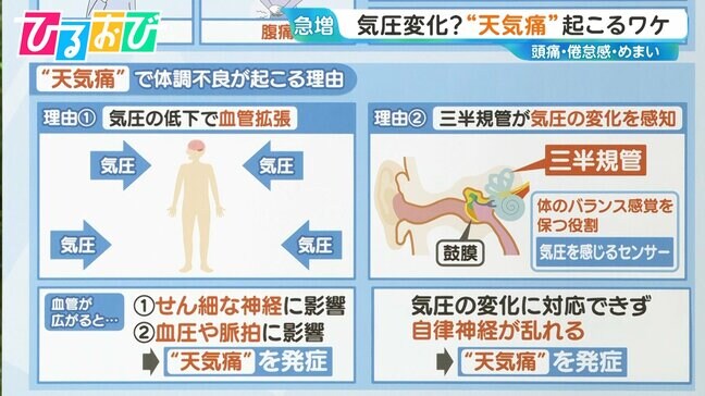『天気痛』はなぜ起こる？気圧低下で頭痛・腹痛…メカニズムと対策を専門家に聞く【ひるおび】|TBS NEWS DIG