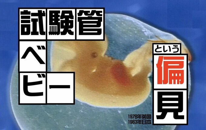 「試験管ベビー」という偏見を打ち破れ（1983年）【TBSアーカイブ秘録】|TBS NEWS DIG